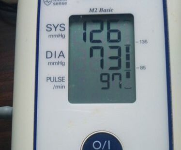 Medición despois de recibir MiCardium