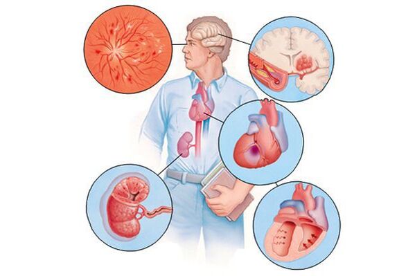 Danos a diferentes órganos con hipertensión arterial máis longa