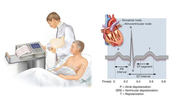 Electrocardiografía para recoñecer enfermidades cardiovasculares con presión arterial alta